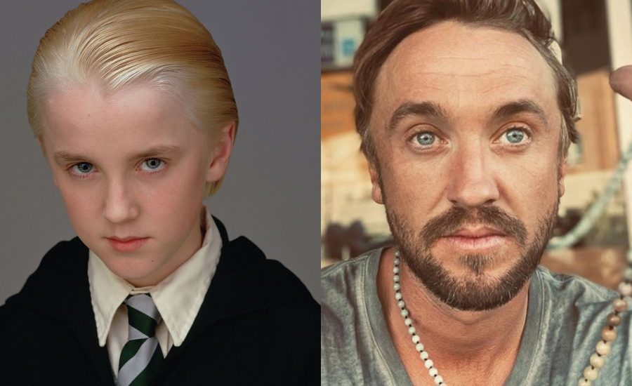 Actor Que Hace De Harry Potter