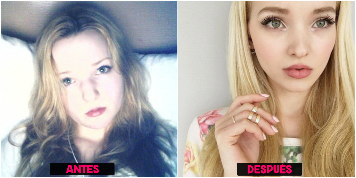 antes y después dove cameron