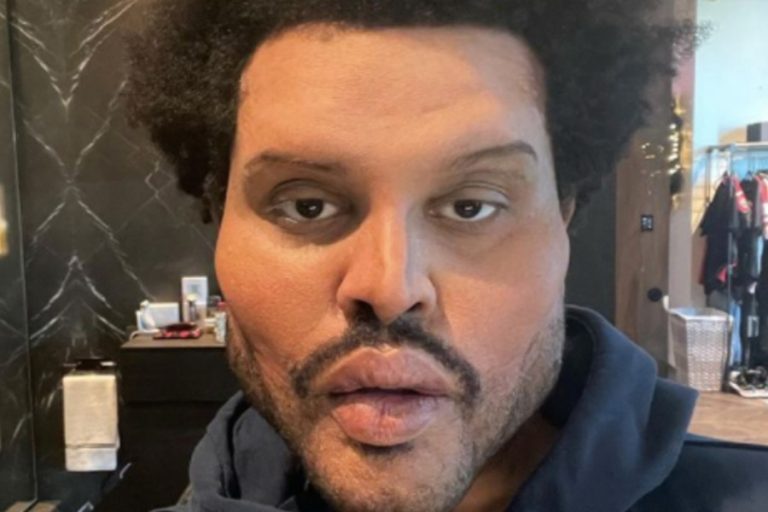 The Weeknd ¿realmente se operó el rostro? Tú en línea
