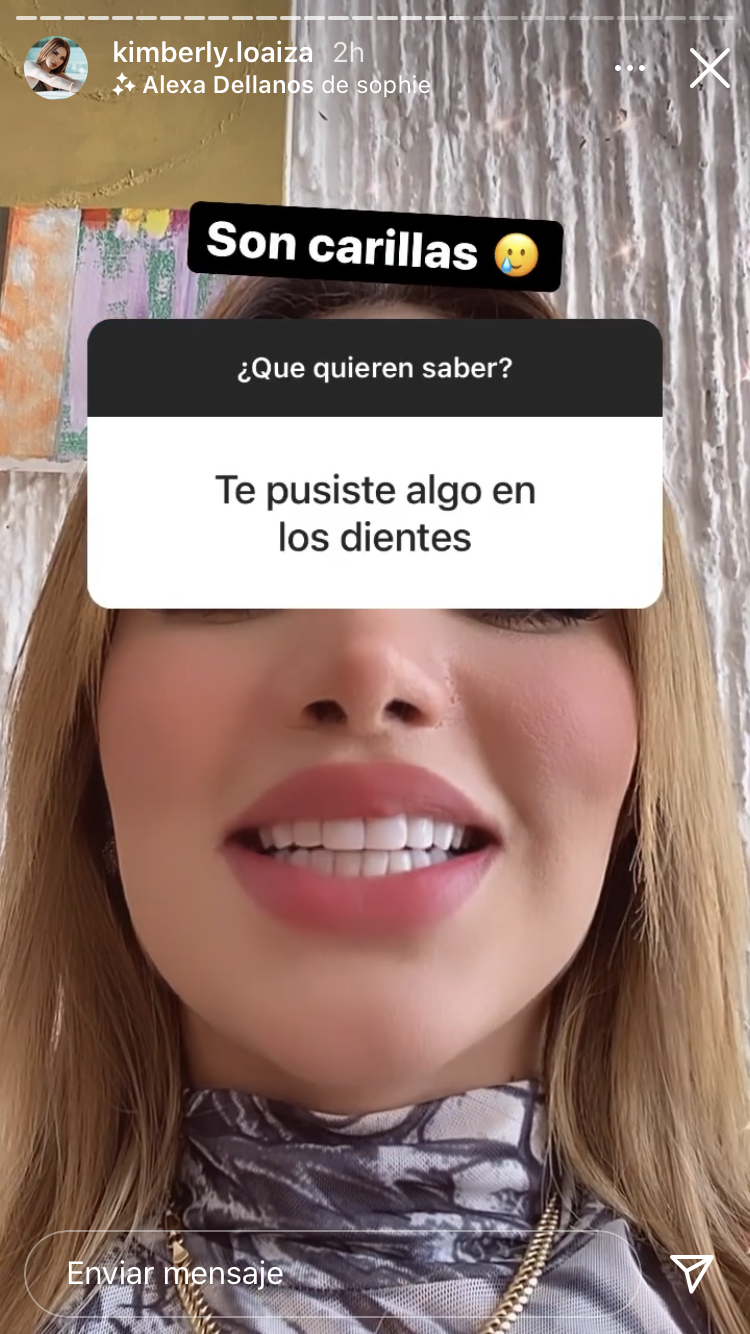 que s ehizo kimberly loaiza en los dientes